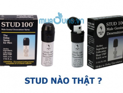 Cách phân biệt stud 100 thật và giả chính xác nhất